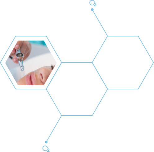 Oxigénesis® facial